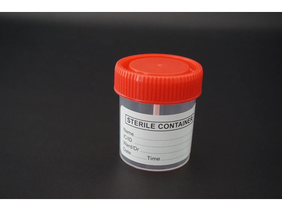 Plastic Stool Urine Container Specimen Cup 30ml 40ml 60ml 120ml
