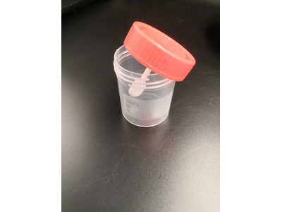Plastic Stool Urine Container Specimen Cup 30ml 40ml 60ml 120ml